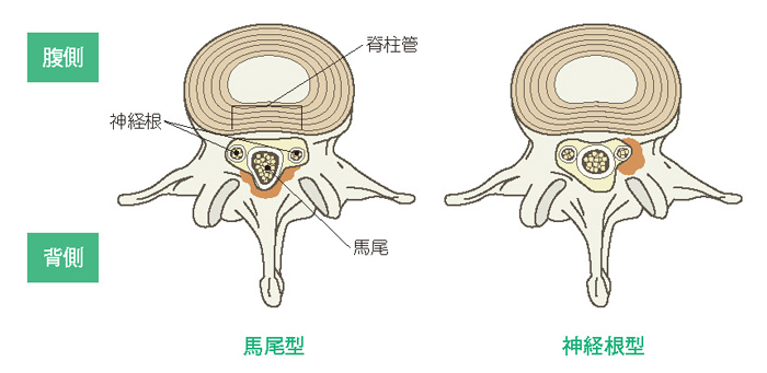 背骨を上からみた図