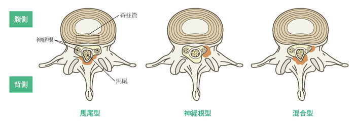 背骨を上からみた図