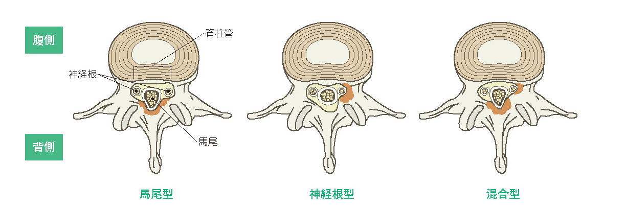 背骨を上からみた図