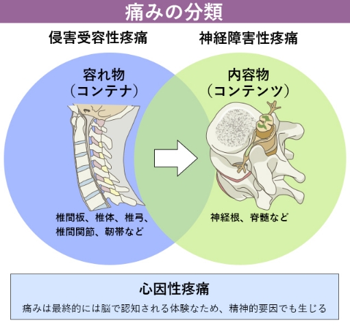 痛み 左 半身